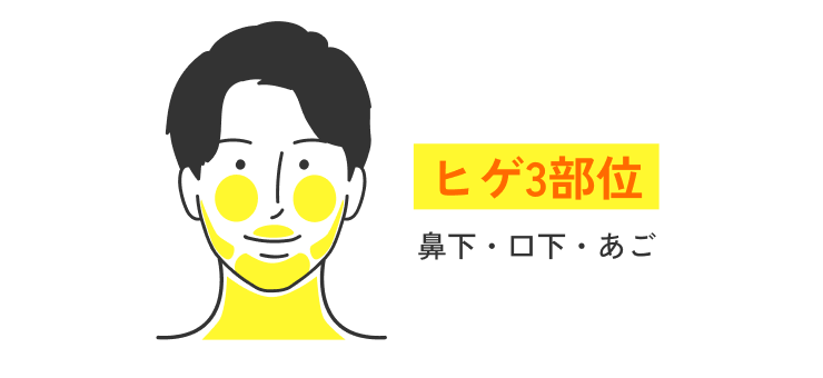 ヒゲ脱毛3部位